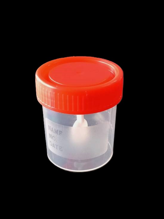 685TYF01-1 Frascos roscados tapa roja 30 ml CON ESPÁTULA PARA HECES. A granel-image